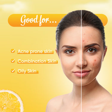 Ozone Acne Check Face Wash, 100g